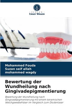 portada Bewertung der Wundheilung nach Gingivadepigmentierung (en Alemán)