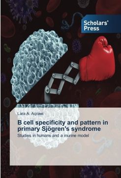 portada B cell specificity and pattern in primary Sjögren's syndrome: Studies in humans and a murine model