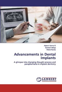 portada Advancements in Dental Implants (en Inglés)