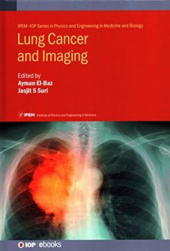 portada Lung Cancer and Imaging (Iop Expanding Physics) (en Inglés)