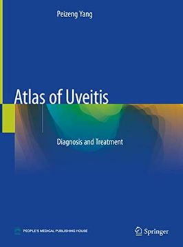 portada Atlas of Uveitis: Diagnosis and Treatment (en Inglés)