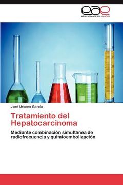 portada tratamiento del hepatocarcinoma (en Inglés)