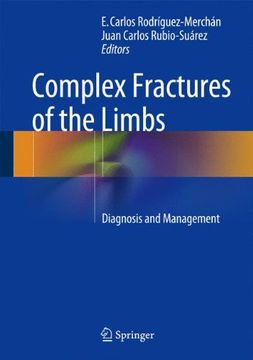 portada Complex Fractures of the Limbs: Diagnosis and Management (en Inglés)