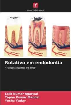 portada Rotativo em Endodontia: Avanços Recentes no Endo (en Portugués)
