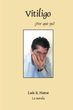 portada Vitiligo (in Spanish)