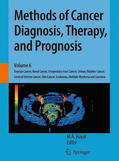 methods of cancer diagnosis, therapy, and prognosis,ovarian cancer, renal cancer, urogenitary tract cancer, urinary bladder cancer, cervical uterine can