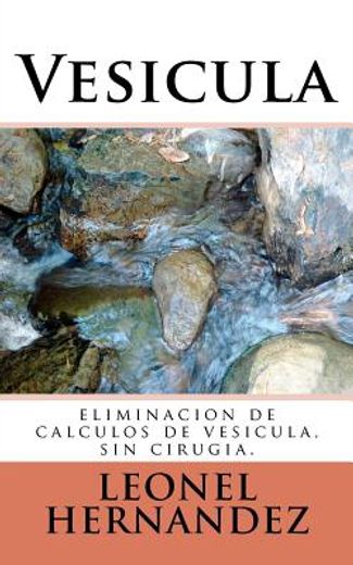 Vesicula: Eliminacion de Calculos de Vesicula, sin Cirugia. (in Spanish)