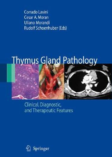 Thymus Gland Pathology: Clinical, Diagnostic and Therapeutic Features (in English)