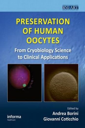 preservation of human oocytes