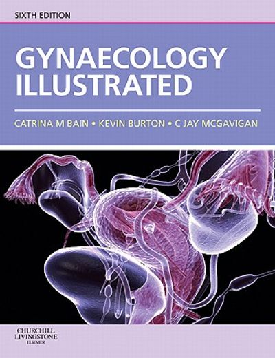 gynaecology illustrated