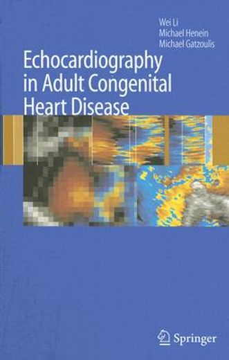 echocardiography in adult congenital heart disease
