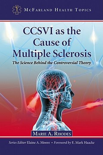 ccsvi as the cause of multiple sclerosis,the science behind the controversial theory