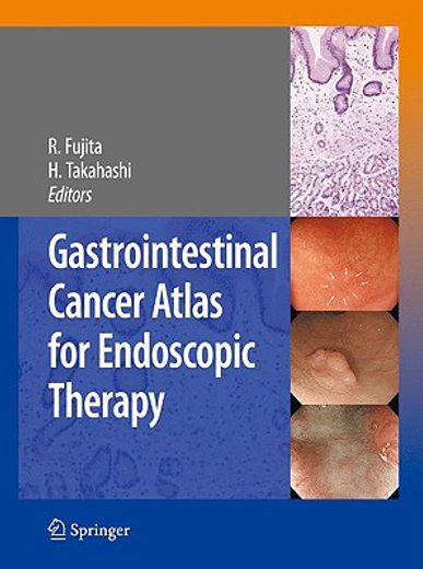 Gastrointestinal Cancer Atlas for Endoscopic Therapy (en Inglés)