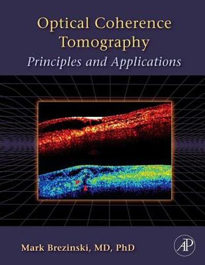 optical coherence tomography,principles and applications