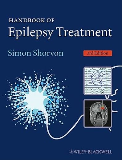 handbook of epilepsy treatment (en Inglés)
