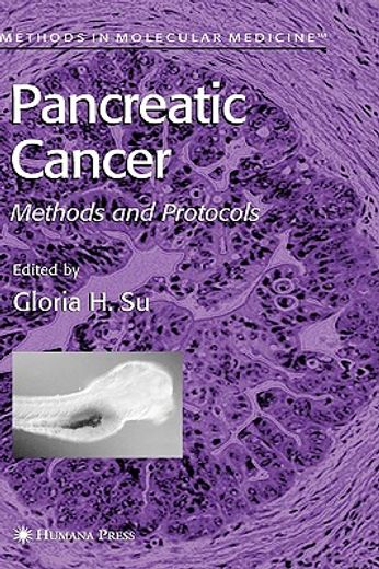 pancreatic cancer (en Inglés)
