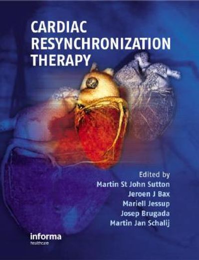 Cardiac Resynchronization Therapy (en Inglés)