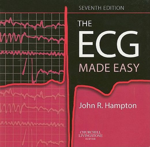 the ecg made easy