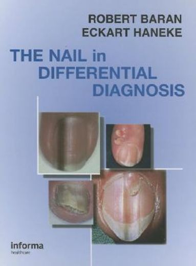 The Nail in Differential Diagnosis (in English)