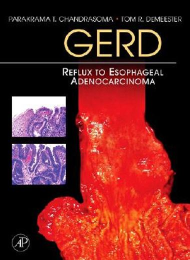 gerd,reflux to esophageal adenocarcinoma