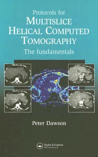protocols for multislice helical computed tomography,the fundamentals