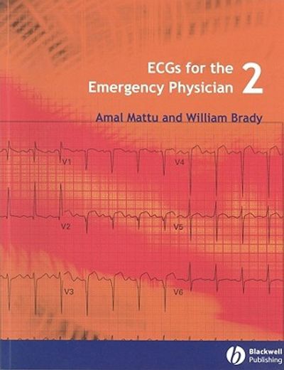 ecgs for the emergency physician (en Inglés)