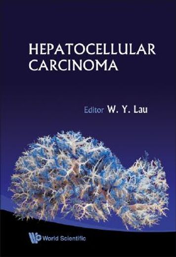 Hepatocellular Carcinoma (en Inglés)