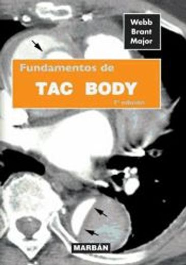 fundamentos de tac body -residente 15-