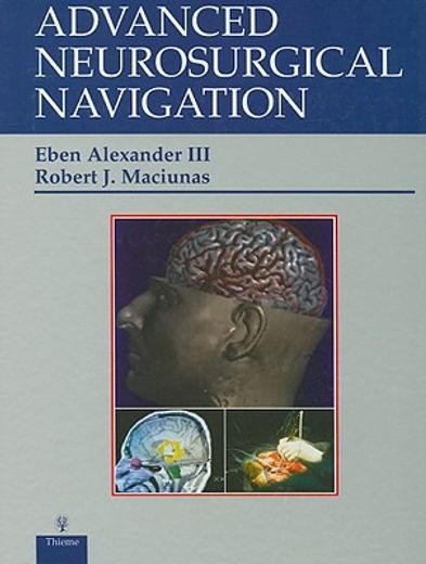advanced neurosurgical naviation