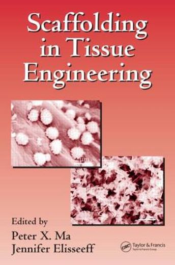 scaffolding in tissue engineering