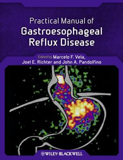 practical manual of gastroesophageal reflux disease (en Inglés)