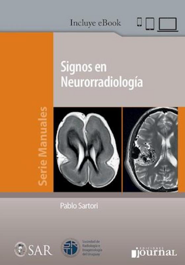 Signos en Neurorradiología (in Spanish)