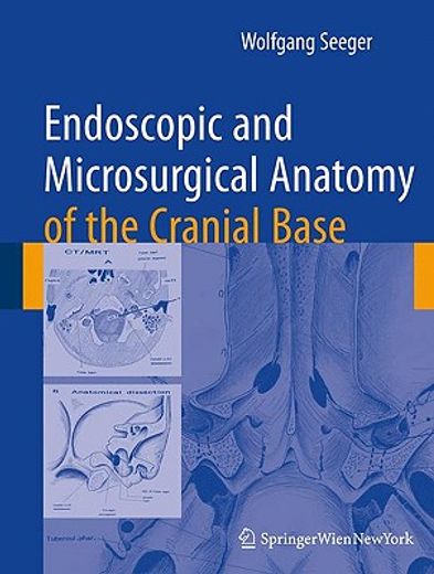 Endoscopic and Microsurgical Anatomy of the Cranial Base (en Inglés)