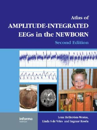 An Atlas of Amplitude-Integrated Eegs in the Newborn [With DVD ROM] (en Inglés)