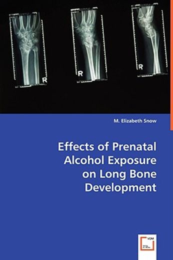 effects on prenatal alcohol exposure on long bone development
