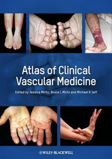 atlas of clinical vascular medicine (in English)