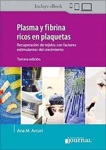 Plasma y Fibrina Ricos en Plaquetas. Recuperación de tejidos con factores estimulantes del crecimiento