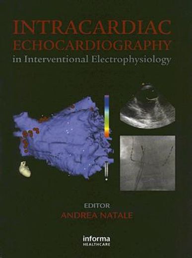 Intracardiac Echocardiography in Interventional Electrophysiology: Advanced Management of Atrial Fibrillation and Ventricular Tachycardia (en Inglés)