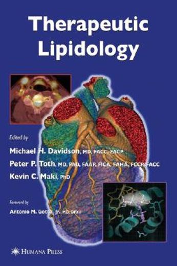 Therapeutic Lipidology (en Inglés)
