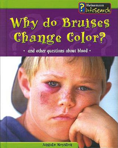 why do bruises change color?,and other questions about blood