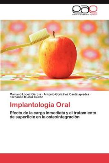 implantolog a oral (in Spanish)