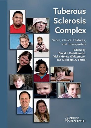 Tuberous Sclerosis Complex: Genes, Clinical Features and Therapeutics (en Inglés)