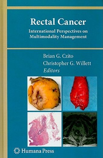 rectal cancer,international perspectives on multimodality management