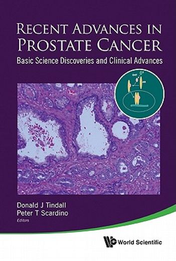 recent advances in prostate cancer,basic science discoveries and clinical advances