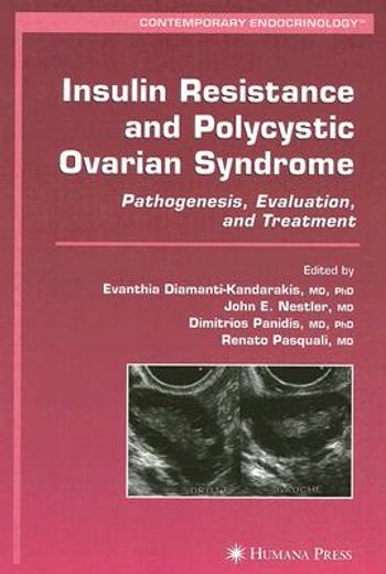 Insulin Resistance and Polycystic Ovarian Syndrome: Pathogenesis, Evaluation, and Treatment (en Inglés)