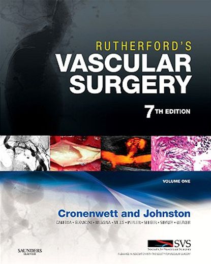 rutherford´s vascular surgery