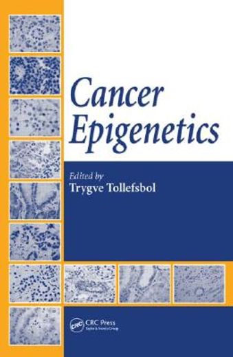 Cancer Epigenetics (en Inglés)
