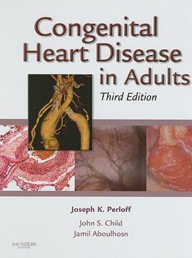 congenital heart disease in adults