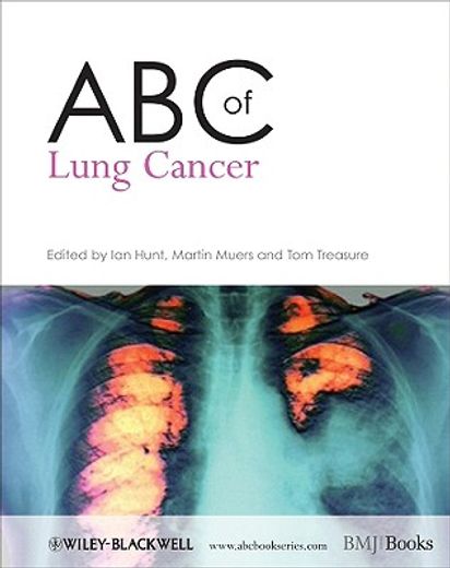 ABC of Lung Cancer (en Inglés)
