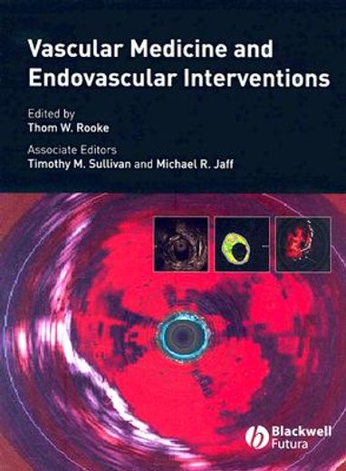 Vascular Medicine and Endovascular Interventions (en Inglés)